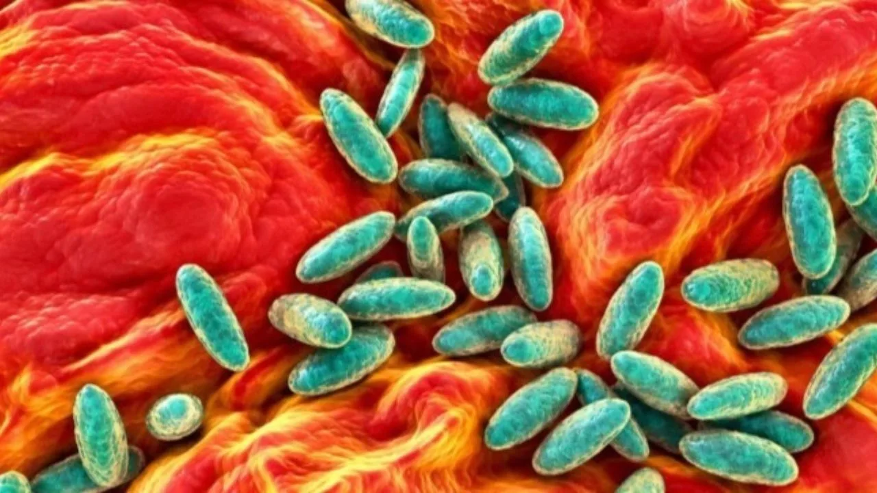 Russia quarantines nearly 200 after anti-plague lab worker dies